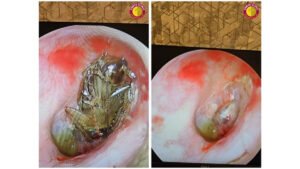 PNN-2026-01-16T143605898